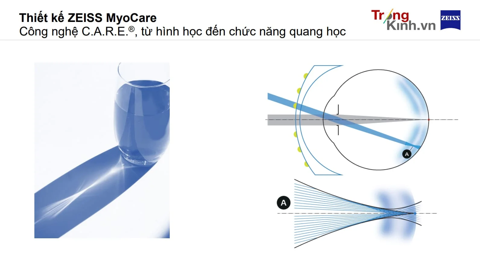 TRONGKINH.VN • Tròng Kính Chính Hãng Uy Tín Tại Tp. Hồ Chí Minh
