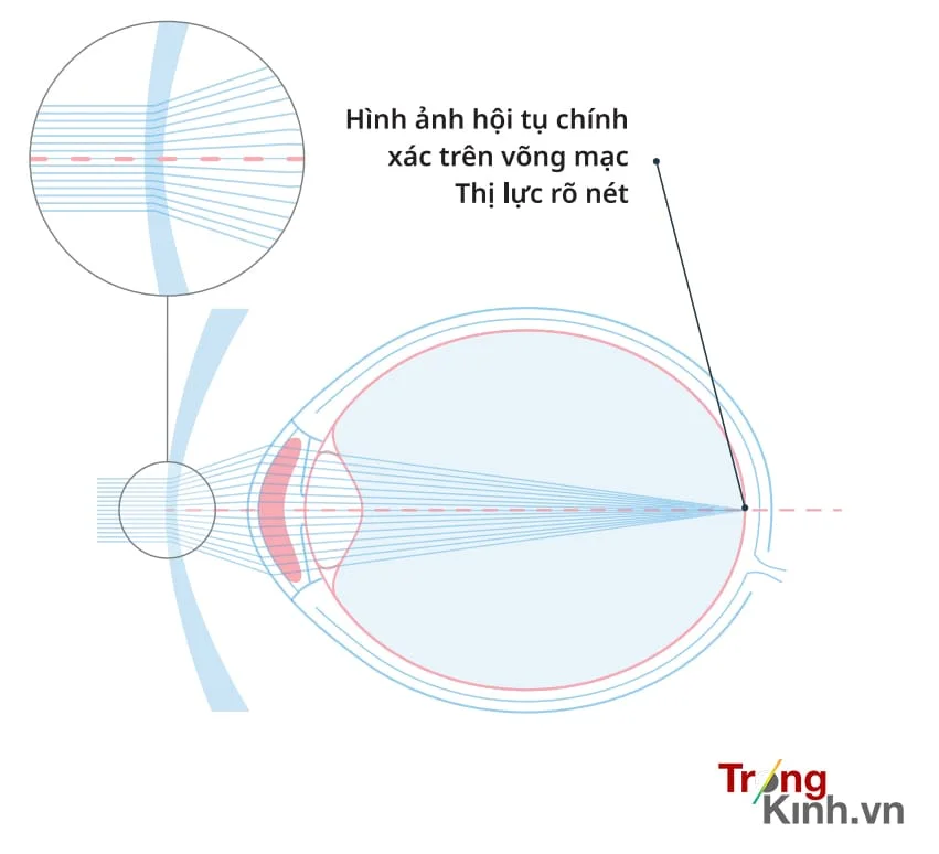 TRONGKINH.VN • Tròng Kính Chính Hãng Uy Tín Tại Tp. Hồ Chí Minh